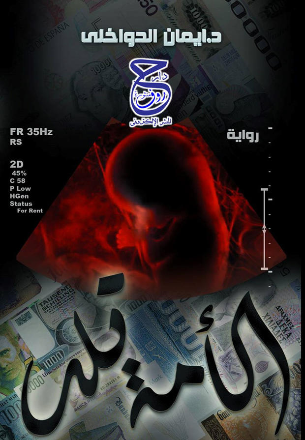 الأمة تلد