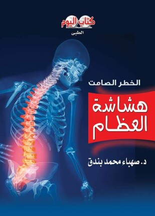 هشاشة العظام الخطر الصامت