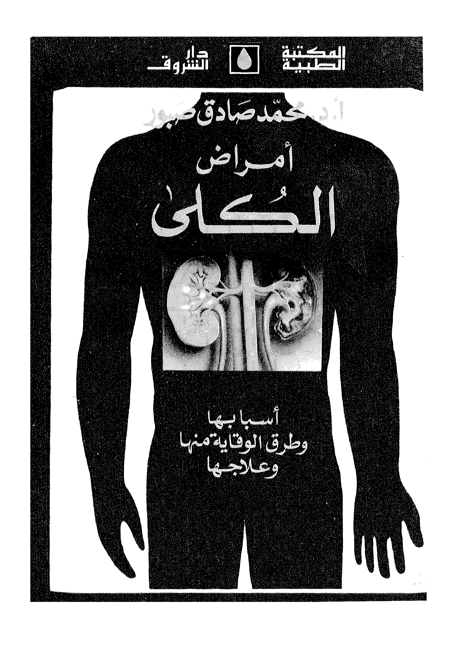 أمراض الكلى..اسبابها وطرق الوقاية منها وعلاجها